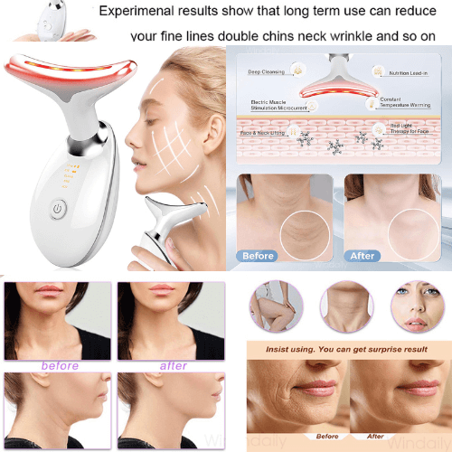 Anti-Wrinkle Beauty Apparatus